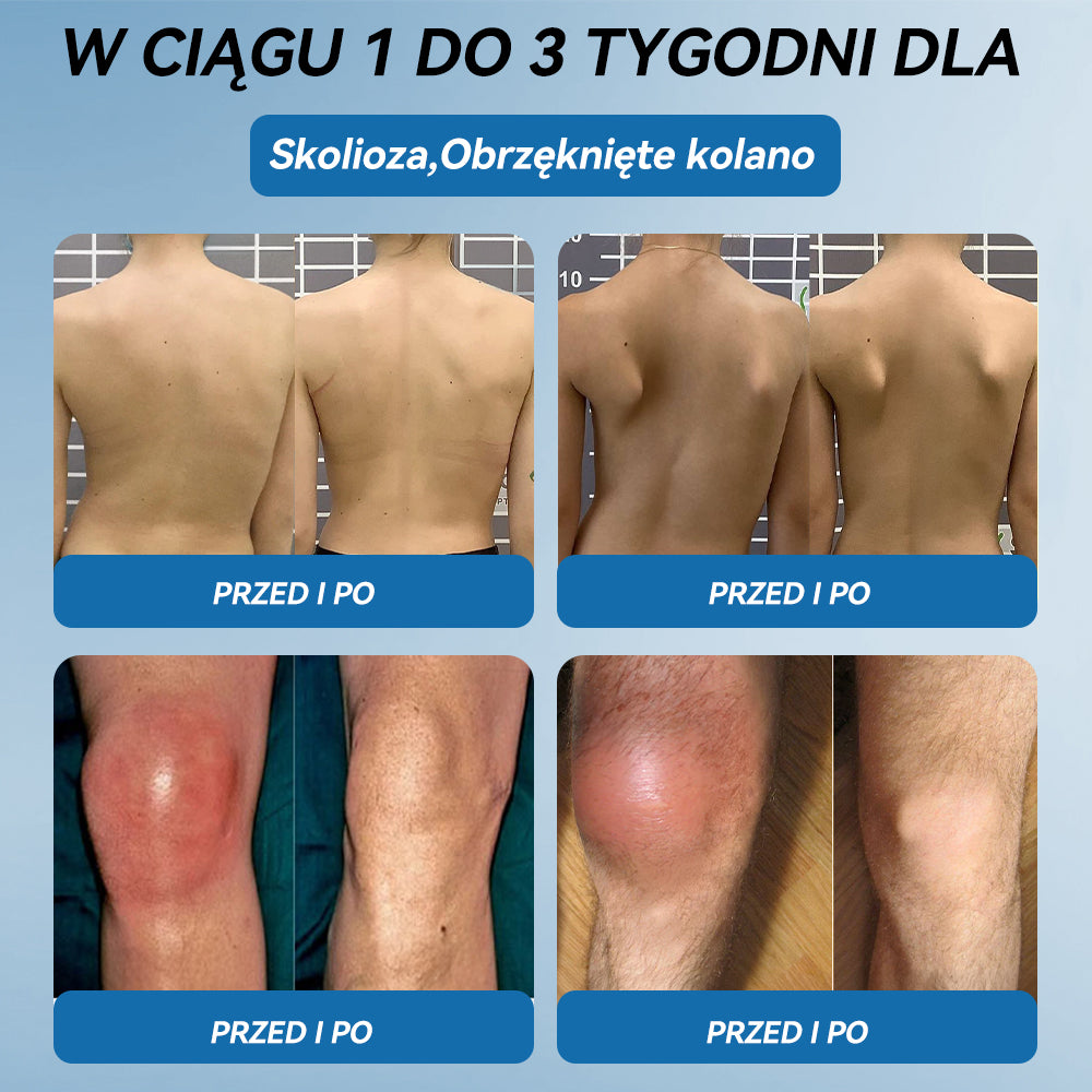 𝑃𝒊𝒄𝐝𝐨® B𝑷𝑪-157 Krem do leczenia stawów 🦴 𝐋𝐞𝐜𝐳𝐞𝐧𝐢𝐞 𝐳𝐚𝐩𝐚𝐥𝐞𝐧𝐢𝐚 𝐬𝐭𝐚𝐰ó𝐰, 𝒏𝒆𝒖𝒓𝒐𝒑𝒂𝒕𝒊𝒊, 𝒓𝒆𝒖𝒎𝒂𝒕𝒚𝒛𝒎𝒖,𝐮𝐫𝐚𝐳ó𝐰 𝐬𝐩𝐨𝐫𝐭𝐨𝐰𝐲𝐜𝐡 𝐢 𝐧𝐢𝐞 𝐭𝐲𝐥𝐤𝐨🍀