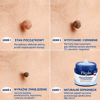 🛒𝐏𝐢𝐜𝐝𝐨® 𝟕-𝐝𝐧𝐢𝐨𝐰𝐲 𝐤𝐫𝐞𝐦 𝐧𝐚 𝐨𝐝𝐜𝐢𝐬𝐤𝐢 𝐬𝐤ó𝐫𝐧𝐞 & 𝐩𝐥𝐚𝐦𝐲 𝐩𝐢𝐠𝐦𝐞𝐧𝐭𝐚𝐜𝐲𝐣𝐧𝐞 (𝐁𝐞𝐳𝐛𝐨𝐥𝐞𝐬𝐧𝐚 𝐟𝐨𝐫𝐦𝐮ł𝐚 – 𝐛𝐞𝐳 𝐛𝐥𝐢𝐳𝐧) 🌼
