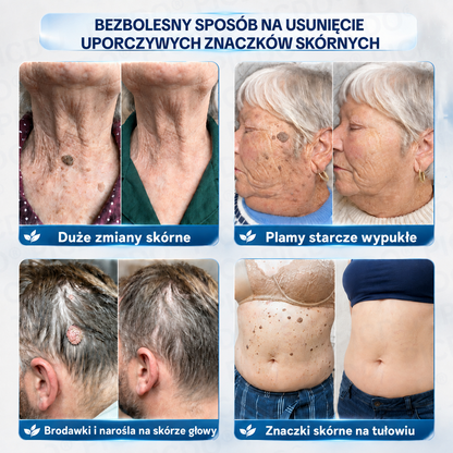 🛒𝐏𝐢𝐜𝐝𝐨® 𝟕-𝐝𝐧𝐢𝐨𝐰𝐲 𝐤𝐫𝐞𝐦 𝐧𝐚 𝐨𝐝𝐜𝐢𝐬𝐤𝐢 𝐬𝐤ó𝐫𝐧𝐞 & 𝐩𝐥𝐚𝐦𝐲 𝐩𝐢𝐠𝐦𝐞𝐧𝐭𝐚𝐜𝐲𝐣𝐧𝐞 (𝐁𝐞𝐳𝐛𝐨𝐥𝐞𝐬𝐧𝐚 𝐟𝐨𝐫𝐦𝐮ł𝐚 – 𝐛𝐞𝐳 𝐛𝐥𝐢𝐳𝐧) 🌼