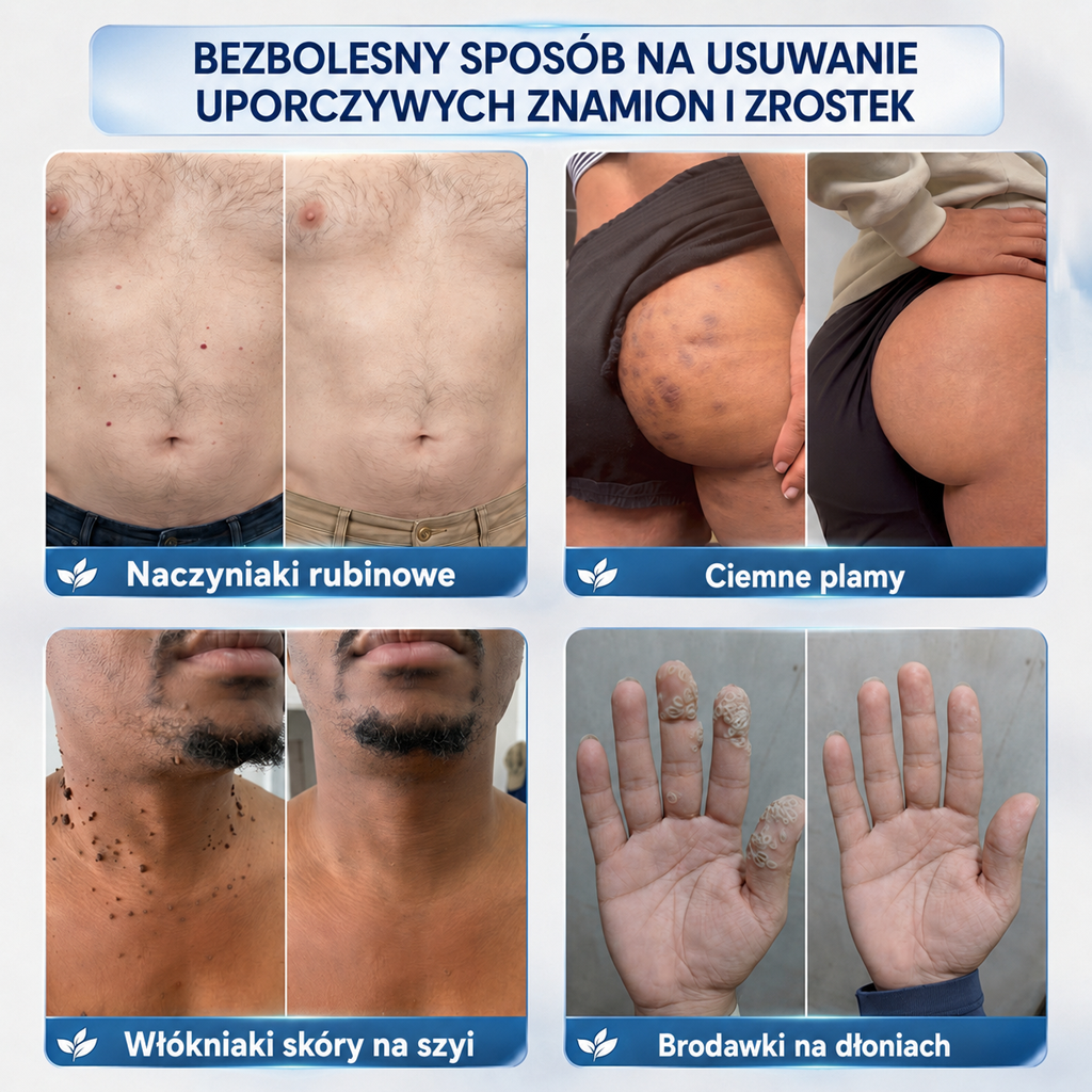 🛒𝐏𝐢𝐜𝐝𝐨® 𝟕-𝐝𝐧𝐢𝐨𝐰𝐲 𝐤𝐫𝐞𝐦 𝐧𝐚 𝐨𝐝𝐜𝐢𝐬𝐤𝐢 𝐬𝐤ó𝐫𝐧𝐞 & 𝐩𝐥𝐚𝐦𝐲 𝐩𝐢𝐠𝐦𝐞𝐧𝐭𝐚𝐜𝐲𝐣𝐧𝐞 (𝐁𝐞𝐳𝐛𝐨𝐥𝐞𝐬𝐧𝐚 𝐟𝐨𝐫𝐦𝐮ł𝐚 – 𝐛𝐞𝐳 𝐛𝐥𝐢𝐳𝐧) 🌼