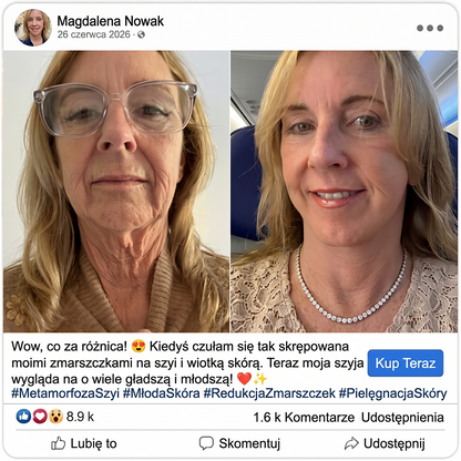 𝑯𝑰𝑺𝑲𝑰𝑵® PDRN Krem Przeciwstarzeniowy 👨‍⚕️ Wygładzenie Zmarszczek & Redukcja Przebarwień w 7 Dni  🍁