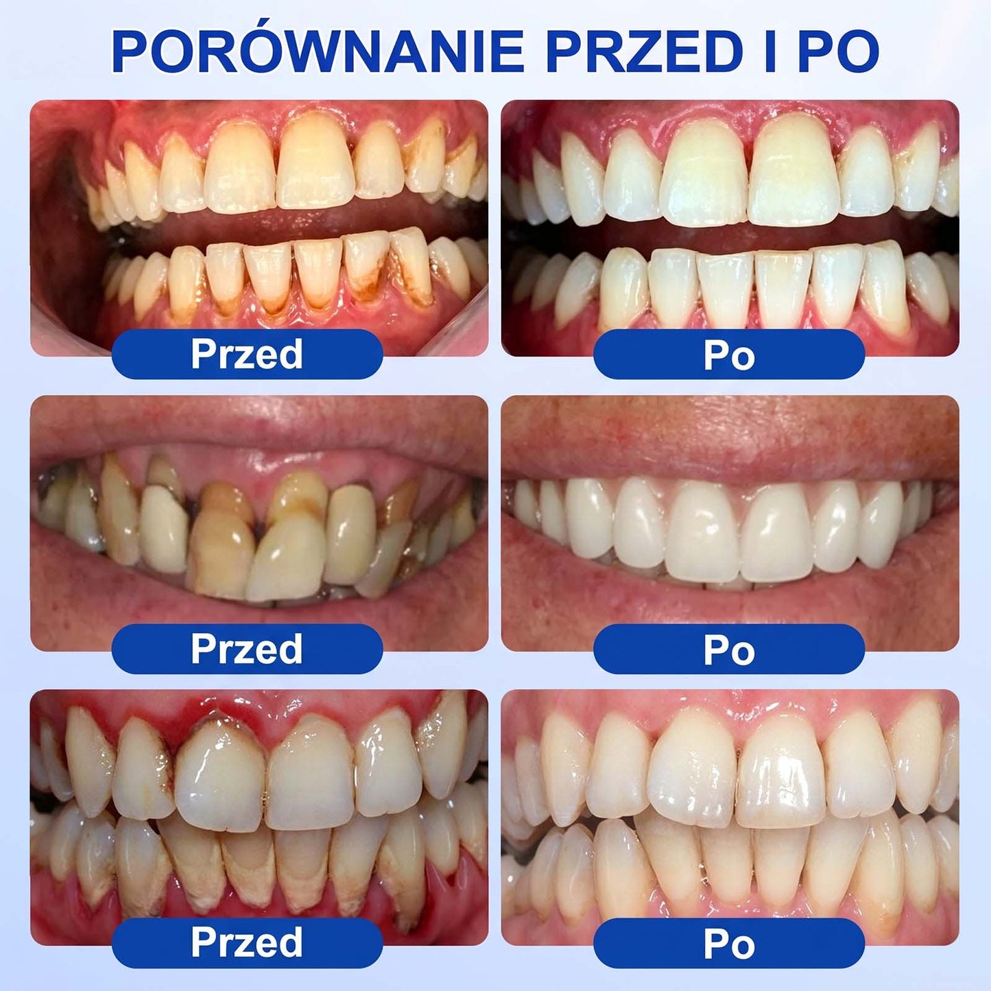 Evolvion® 🦷 GumRevive – żel do regeneracji przyzębia🍎1️⃣