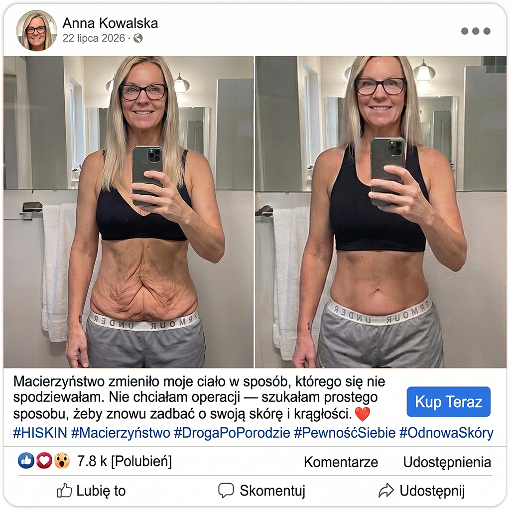 𝑯𝑰𝑺𝑲𝑰𝑵® PDRN Krem Przeciwstarzeniowy 👨‍⚕️ Wygładzenie Zmarszczek & Redukcja Przebarwień w 7 Dni  🍁