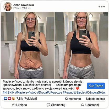 𝑯𝑰𝑺𝑲𝑰𝑵® PDRN Krem Przeciwstarzeniowy 👨‍⚕️ Wygładzenie Zmarszczek & Redukcja Przebarwień w 7 Dni  🍁