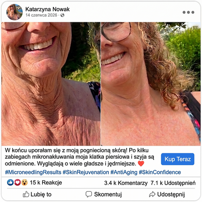 𝑯𝑰𝑺𝑲𝑰𝑵® PDRN Krem Przeciwstarzeniowy 👨‍⚕️ Wygładzenie Zmarszczek & Redukcja Przebarwień w 7 Dni  🍁