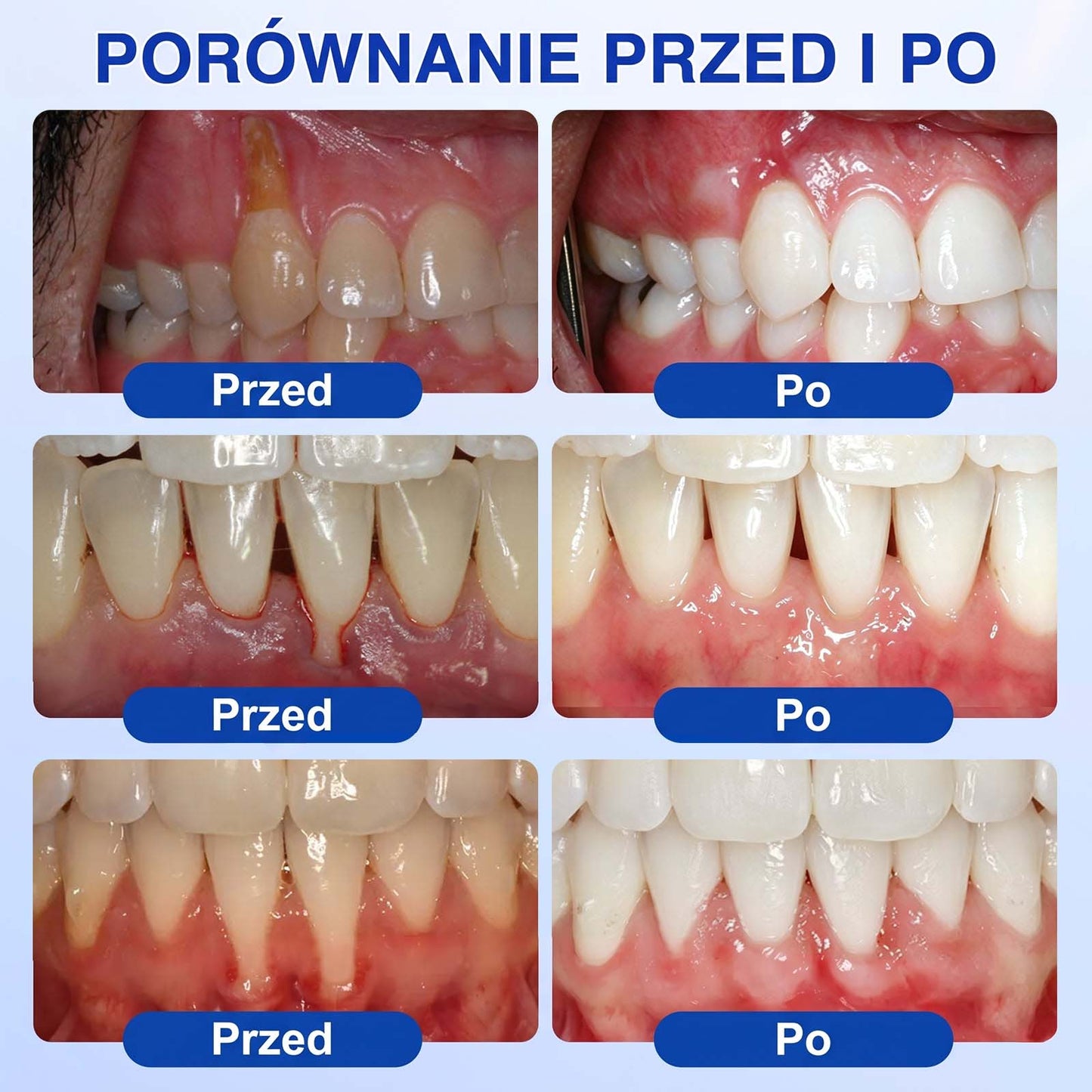 Evolvion® 🦷 GumRevive – żel do regeneracji przyzębia🍎1️⃣