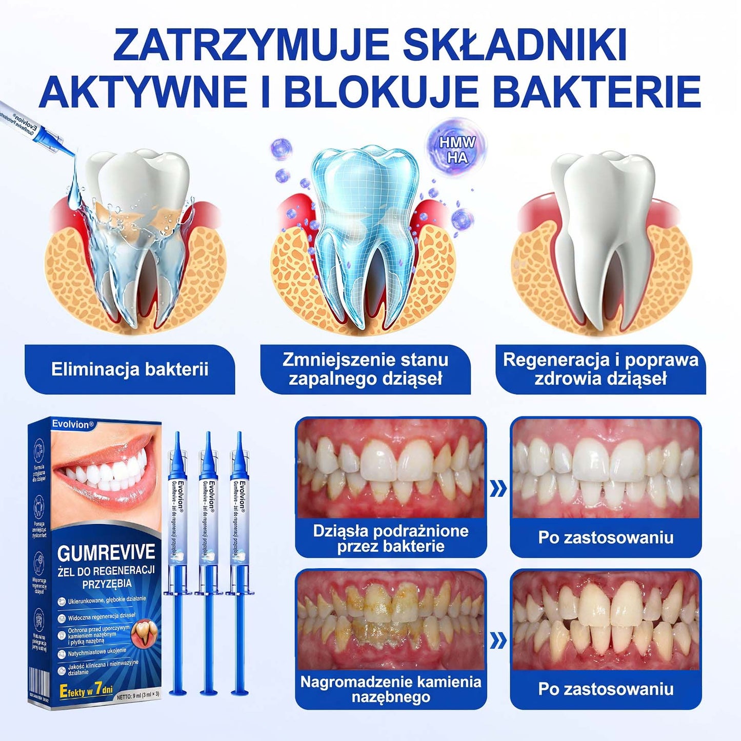 Evolvion® 🦷 GumRevive – żel do regeneracji przyzębia🍎1️⃣