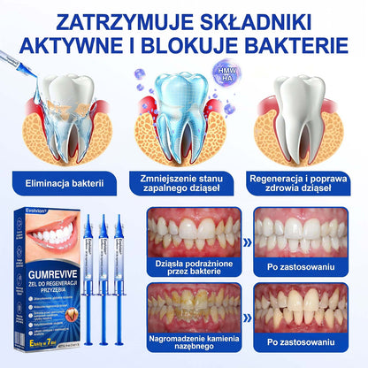 Evolvion® 🦷 GumRevive – żel do regeneracji przyzębia🍎1️⃣