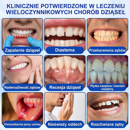 Evolvion® 🦷 GumRevive – żel do regeneracji przyzębia🍎1️⃣