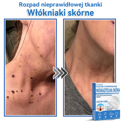 Celsiora® 2 w 1 – mikronakłuwające i hydrożelowe plastry na znamiona, trądzik i niedoskonałości skóry🎁