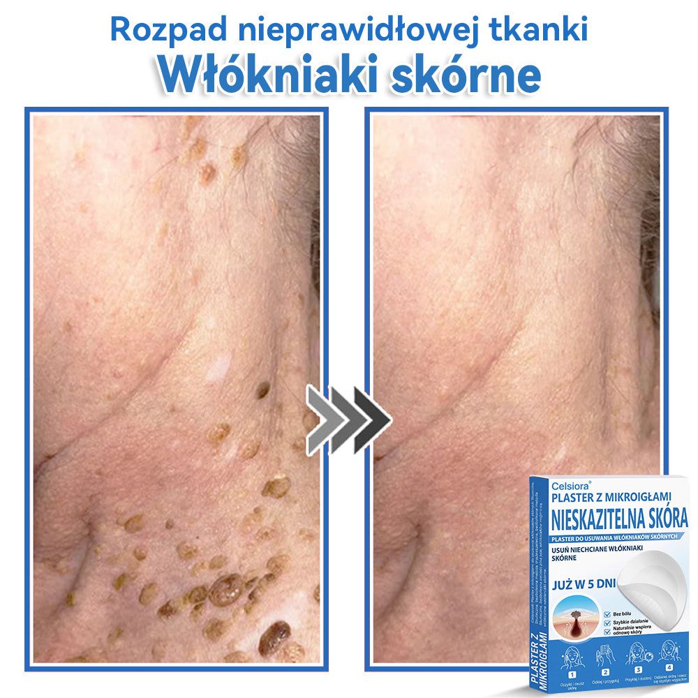 Celsiora® 2 w 1 – mikronakłuwające i hydrożelowe plastry na znamiona, trądzik i niedoskonałości skóry🎁