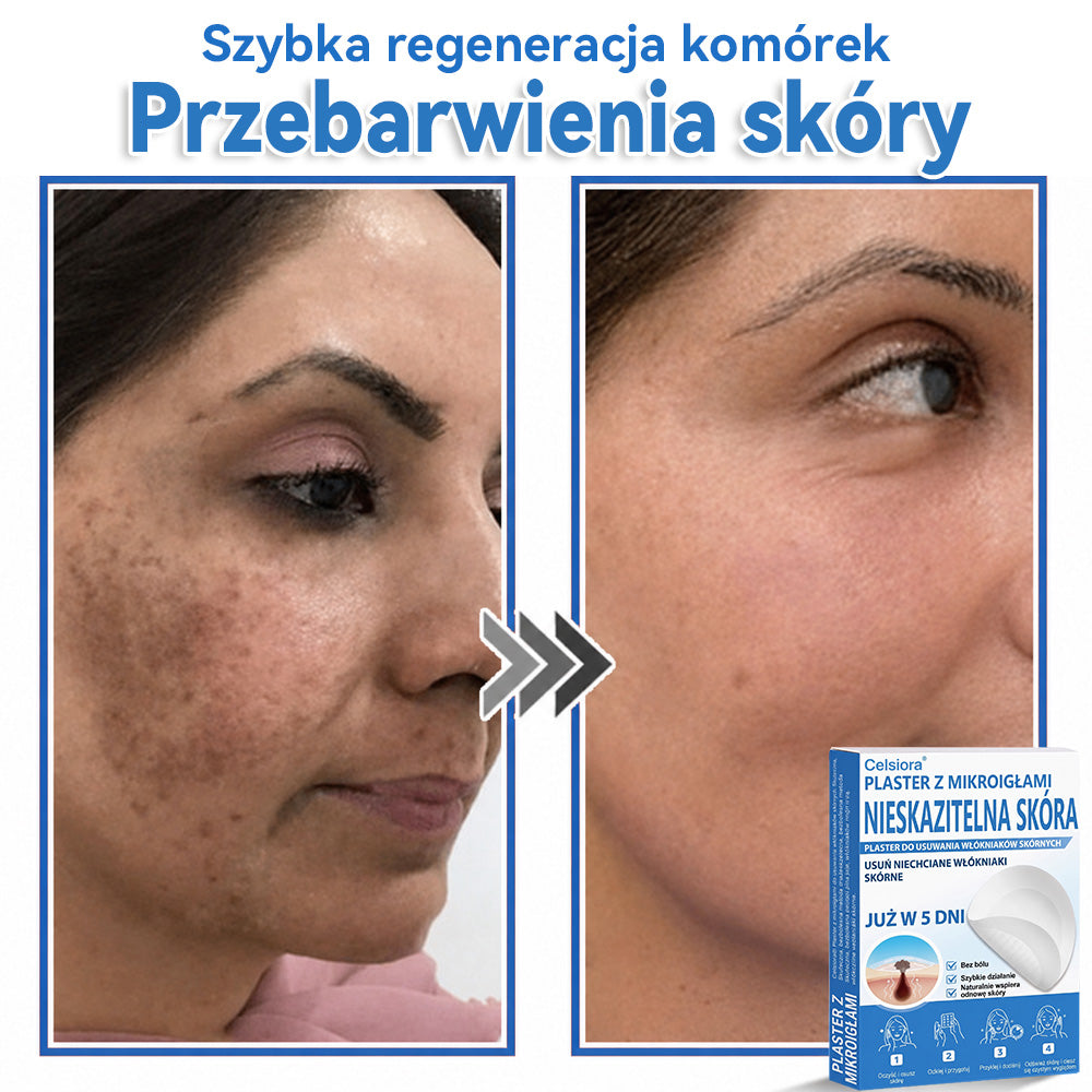 Celsiora® 2 w 1 – mikronakłuwające i hydrożelowe plastry na znamiona, trądzik i niedoskonałości skóry🎁