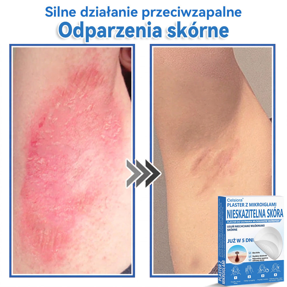 Celsiora® 2 w 1 – mikronakłuwające i hydrożelowe plastry na znamiona, trądzik i niedoskonałości skóry🎁