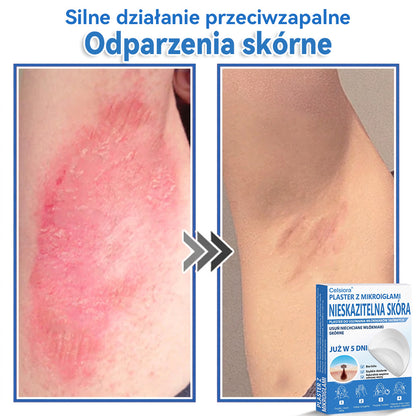 Celsiora® 2 w 1 – mikronakłuwające i hydrożelowe plastry na znamiona, trądzik i niedoskonałości skóry🎁