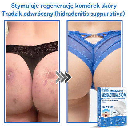 Celsiora® 2 w 1 – mikronakłuwające i hydrożelowe plastry na znamiona, trądzik i niedoskonałości skóry🎁