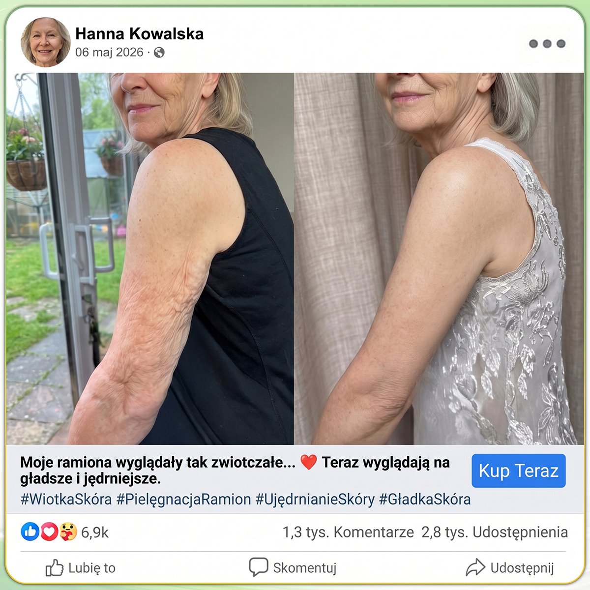 𝑯𝑰𝑺𝑲𝑰𝑵® PDRN Krem Przeciwstarzeniowy 👨‍⚕️ Wygładzenie Zmarszczek & Redukcja Przebarwień w 7 Dni  🍁