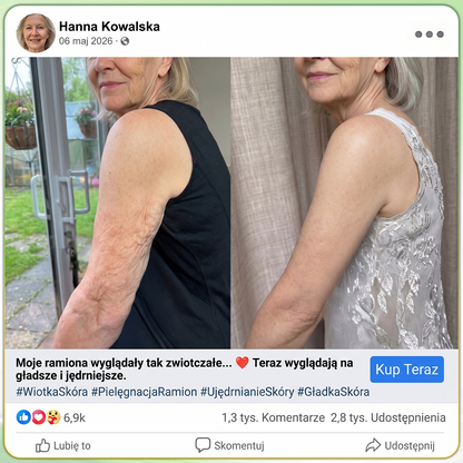 𝑯𝑰𝑺𝑲𝑰𝑵® PDRN Krem Przeciwstarzeniowy 👨‍⚕️ Wygładzenie Zmarszczek & Redukcja Przebarwień w 7 Dni  🍁