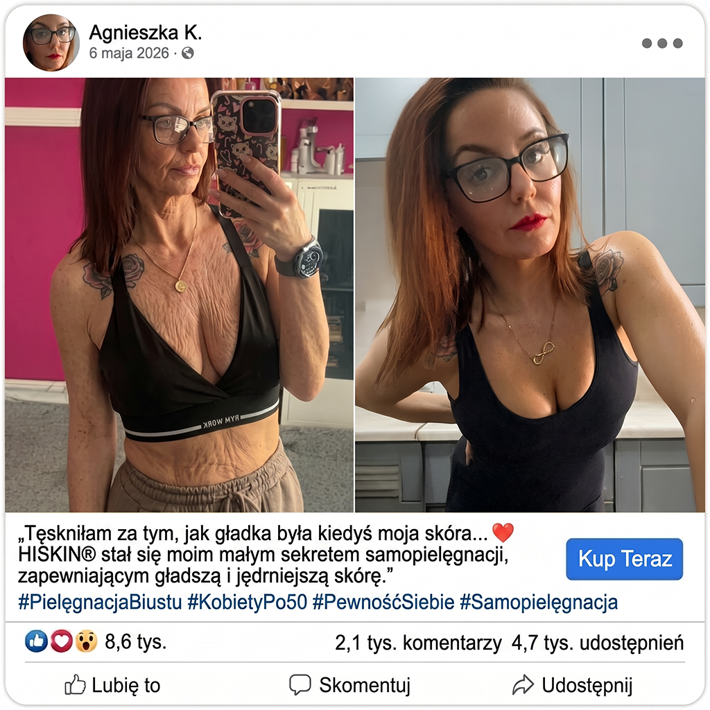 𝑯𝑰𝑺𝑲𝑰𝑵® PDRN Krem Przeciwstarzeniowy 👨‍⚕️ Wygładzenie Zmarszczek & Redukcja Przebarwień w 7 Dni  🍁