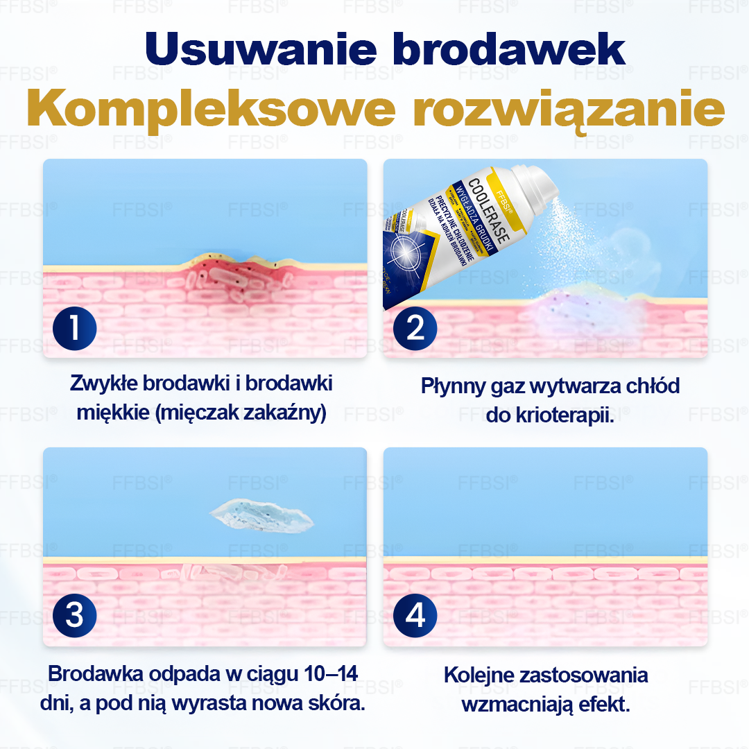 FFBSI®  CoolErase Spray do regeneracji skóry☘️(Brodawe, Pęcherze, Wypryski, Łuszczyca, Zmiany skórne, Trądzik, Skórne narośle, Blizny, Pieprzyki)