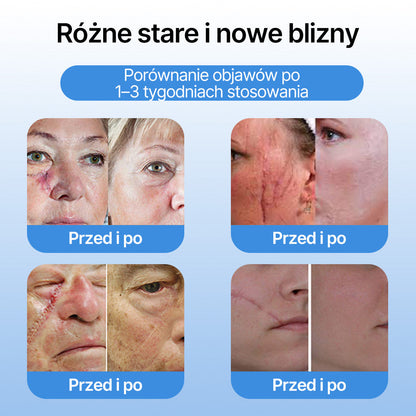 𝗹𝘂𝙠𝙢𝙡𝙘𝙖® 𝑪𝒐𝒐𝒍𝑬𝒓𝒂𝒔𝒆 𝑺𝒑𝒓𝒂𝒚 𝒅𝒐 𝒓𝒆𝒈𝒆𝒏𝒆𝒓𝒂𝒄𝒋𝒊 𝒔𝒌ó𝒓𝒚 🌿(𝑏𝑟𝑜𝑑𝑎𝑤𝑘𝑖, 𝑝ę𝑐ℎ𝑒𝑟𝑧𝑒, 𝑤𝑦𝑠𝑦𝑝𝑘𝑖, ł𝑢𝑠𝑧𝑐𝑧𝑦𝑐𝑎, 𝑝𝑟𝑜𝑏𝑙𝑒𝑚𝑦 𝑠𝑘ó𝑟𝑛𝑒, 𝑡𝑟ą𝑑𝑧𝑖𝑘, 𝑛𝑎𝑟𝑜ś𝑙𝑎 𝑠𝑘ó𝑟𝑛𝑒, 𝑏𝑙𝑖𝑧𝑛𝑦, 𝑧𝑛𝑎𝑚𝑖𝑜𝑛𝑎)🔥