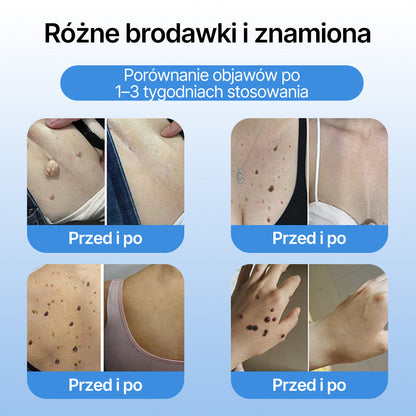 𝗹𝘂𝙠𝙢𝙡𝙘𝙖® 𝑪𝒐𝒐𝒍𝑬𝒓𝒂𝒔𝒆 𝑺𝒑𝒓𝒂𝒚 𝒅𝒐 𝒓𝒆𝒈𝒆𝒏𝒆𝒓𝒂𝒄𝒋𝒊 𝒔𝒌ó𝒓𝒚 🌿(𝑏𝑟𝑜𝑑𝑎𝑤𝑘𝑖, 𝑝ę𝑐ℎ𝑒𝑟𝑧𝑒, 𝑤𝑦𝑠𝑦𝑝𝑘𝑖, ł𝑢𝑠𝑧𝑐𝑧𝑦𝑐𝑎, 𝑝𝑟𝑜𝑏𝑙𝑒𝑚𝑦 𝑠𝑘ó𝑟𝑛𝑒, 𝑡𝑟ą𝑑𝑧𝑖𝑘, 𝑛𝑎𝑟𝑜ś𝑙𝑎 𝑠𝑘ó𝑟𝑛𝑒, 𝑏𝑙𝑖𝑧𝑛𝑦, 𝑧𝑛𝑎𝑚𝑖𝑜𝑛𝑎)🔥