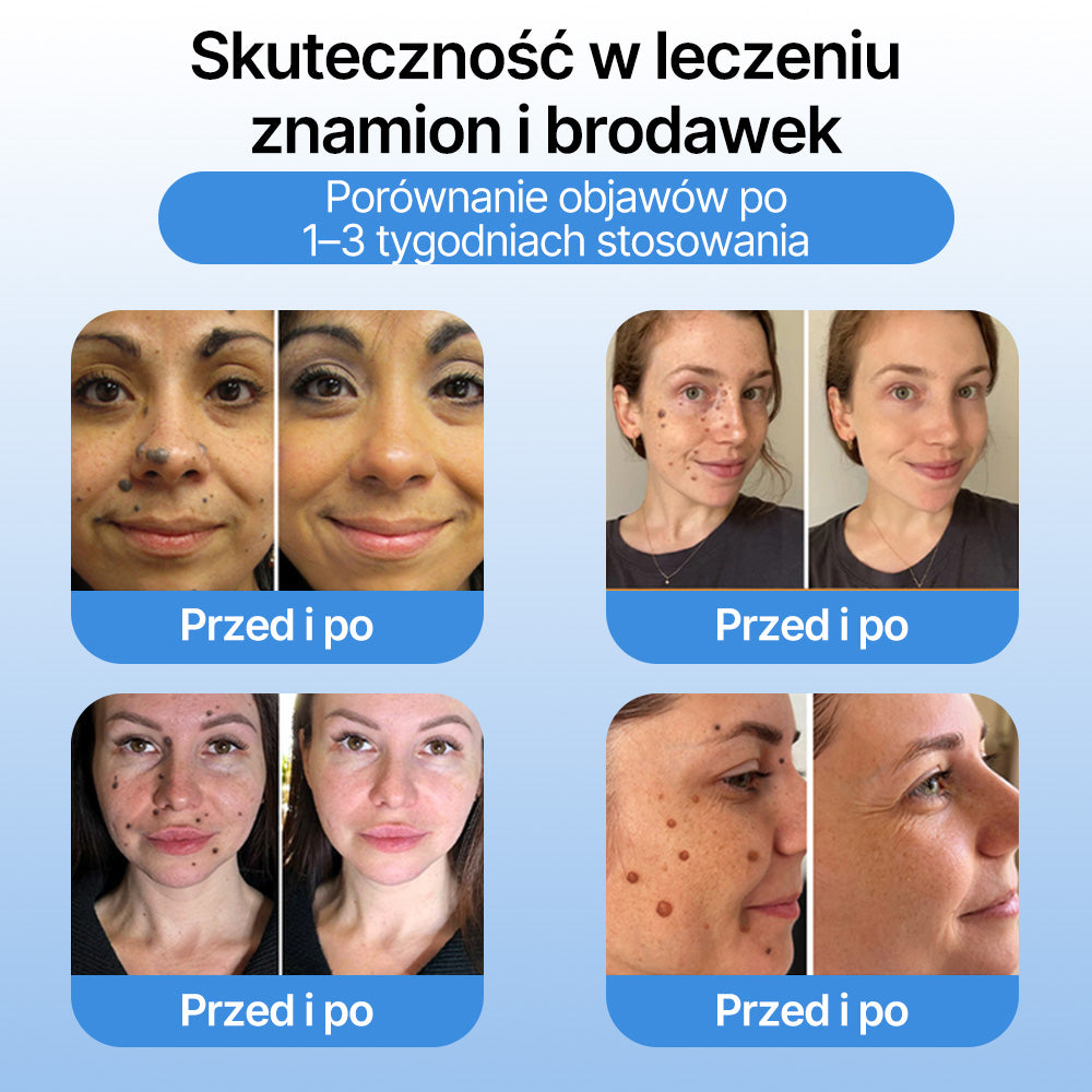 𝗹𝘂𝙠𝙢𝙡𝙘𝙖® 𝑪𝒐𝒐𝒍𝑬𝒓𝒂𝒔𝒆 𝑺𝒑𝒓𝒂𝒚 𝒅𝒐 𝒓𝒆𝒈𝒆𝒏𝒆𝒓𝒂𝒄𝒋𝒊 𝒔𝒌ó𝒓𝒚 🌿(𝑏𝑟𝑜𝑑𝑎𝑤𝑘𝑖, 𝑝ę𝑐ℎ𝑒𝑟𝑧𝑒, 𝑤𝑦𝑠𝑦𝑝𝑘𝑖, ł𝑢𝑠𝑧𝑐𝑧𝑦𝑐𝑎, 𝑝𝑟𝑜𝑏𝑙𝑒𝑚𝑦 𝑠𝑘ó𝑟𝑛𝑒, 𝑡𝑟ą𝑑𝑧𝑖𝑘, 𝑛𝑎𝑟𝑜ś𝑙𝑎 𝑠𝑘ó𝑟𝑛𝑒, 𝑏𝑙𝑖𝑧𝑛𝑦, 𝑧𝑛𝑎𝑚𝑖𝑜𝑛𝑎)🔥