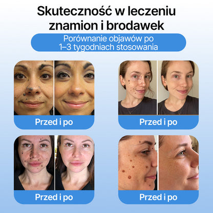 𝗹𝘂𝙠𝙢𝙡𝙘𝙖® 𝑪𝒐𝒐𝒍𝑬𝒓𝒂𝒔𝒆 𝑺𝒑𝒓𝒂𝒚 𝒅𝒐 𝒓𝒆𝒈𝒆𝒏𝒆𝒓𝒂𝒄𝒋𝒊 𝒔𝒌ó𝒓𝒚 🌿(𝑏𝑟𝑜𝑑𝑎𝑤𝑘𝑖, 𝑝ę𝑐ℎ𝑒𝑟𝑧𝑒, 𝑤𝑦𝑠𝑦𝑝𝑘𝑖, ł𝑢𝑠𝑧𝑐𝑧𝑦𝑐𝑎, 𝑝𝑟𝑜𝑏𝑙𝑒𝑚𝑦 𝑠𝑘ó𝑟𝑛𝑒, 𝑡𝑟ą𝑑𝑧𝑖𝑘, 𝑛𝑎𝑟𝑜ś𝑙𝑎 𝑠𝑘ó𝑟𝑛𝑒, 𝑏𝑙𝑖𝑧𝑛𝑦, 𝑧𝑛𝑎𝑚𝑖𝑜𝑛𝑎)🔥
