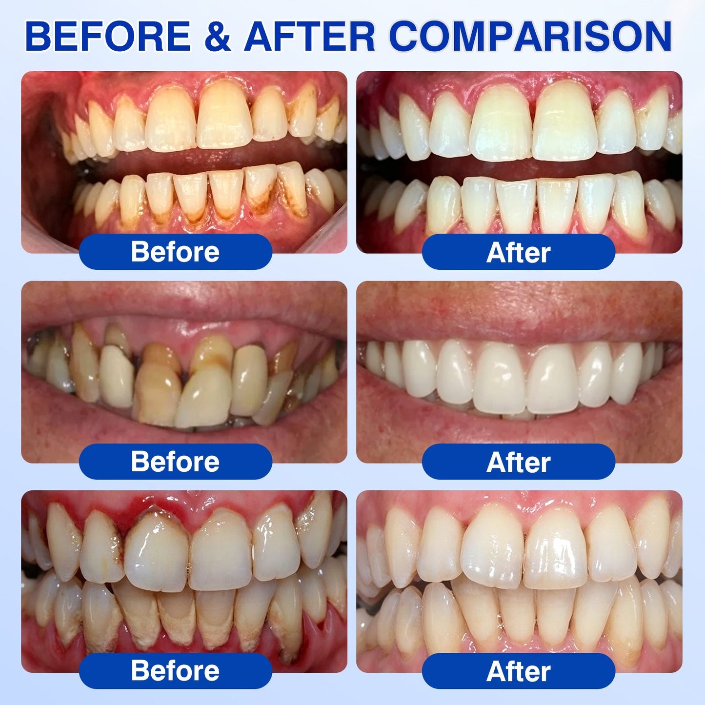 🇬🇧👨‍⚕️🦷✨Evolvion® GumRevive Periodontal Repair Gel