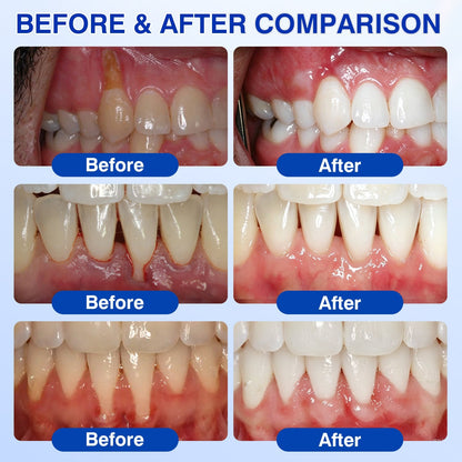 🇬🇧👨‍⚕️🦷✨Evolvion® GumRevive Periodontal Repair Gel