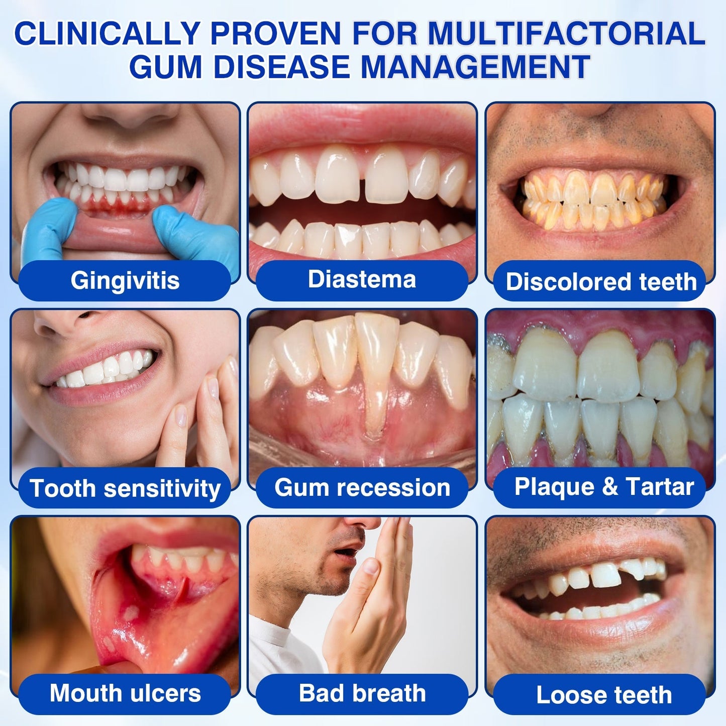 🇬🇧👨‍⚕️🦷✨Evolvion® GumRevive Periodontal Repair Gel