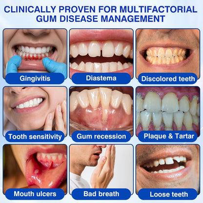 🇬🇧👨‍⚕️🦷✨Evolvion® GumRevive Periodontal Repair Gel