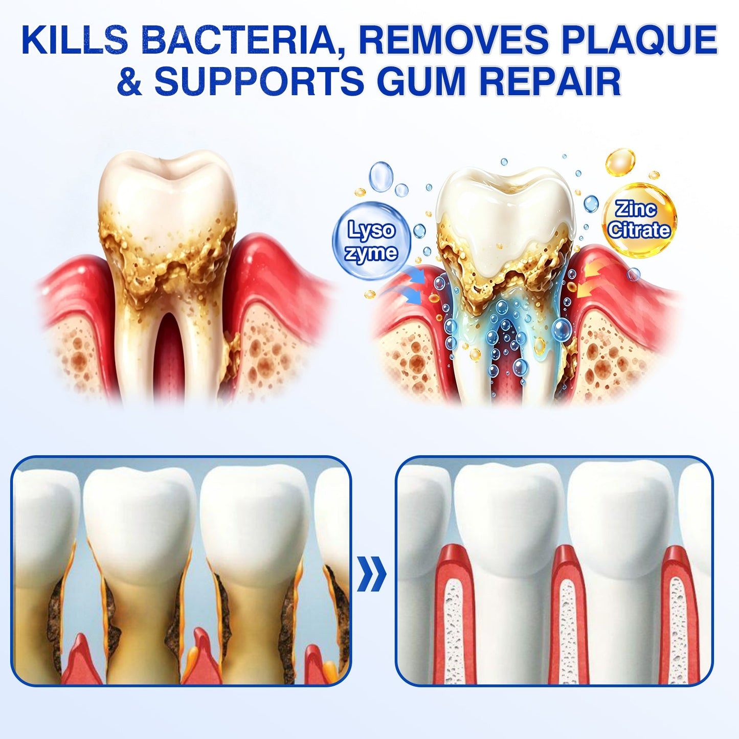 🇬🇧👨‍⚕️🦷✨Evolvion® GumRevive Periodontal Repair Gel