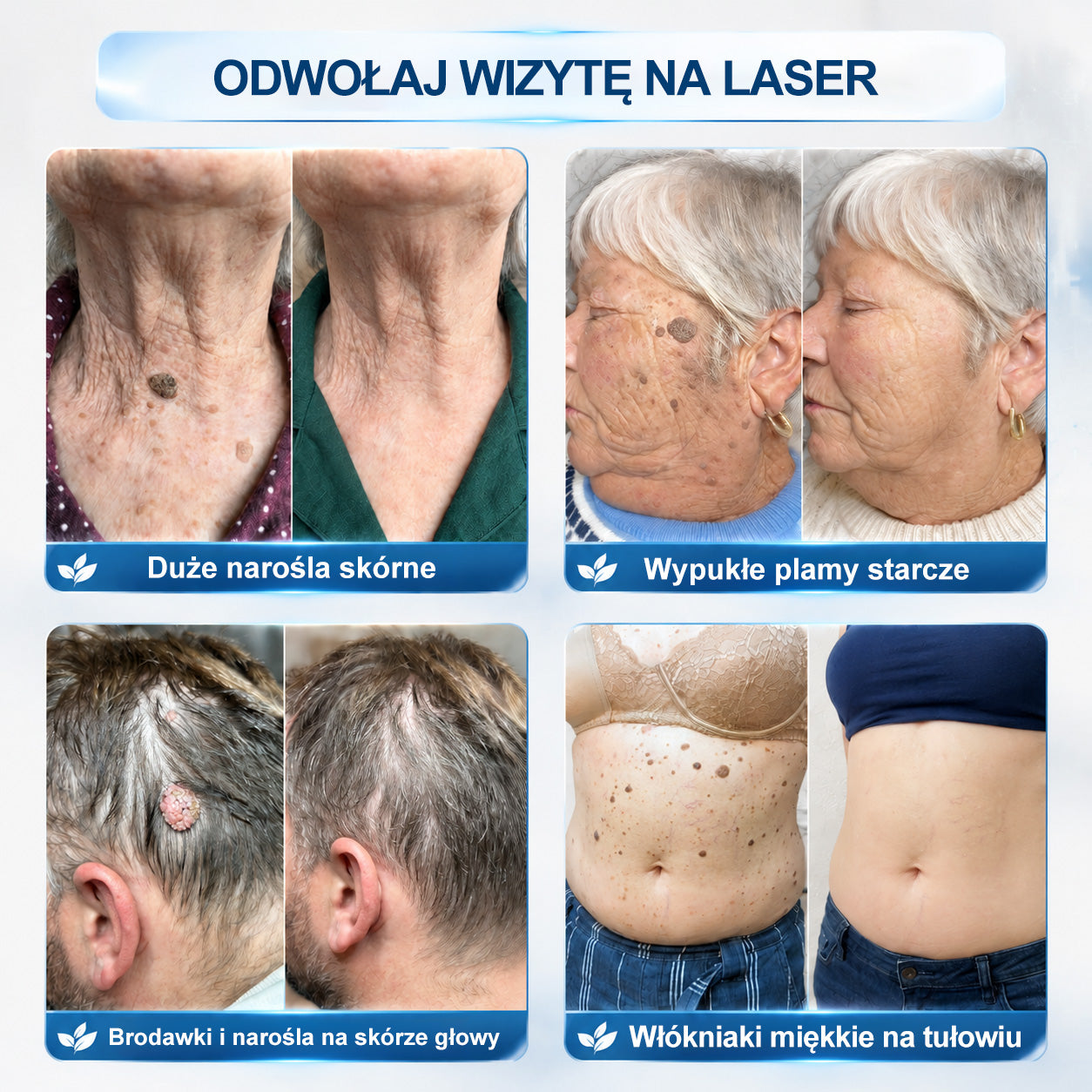 Oficjalny Sklep Markowy | ✅👩‍⚕️ 𝐏i𝐜𝐝o® 7-Dniowy 𝗧𝗮𝗴 & 𝗦𝗽𝗼𝐭 𝐄𝐫𝐚𝐬𝐞𝐫 (Bez bólu, Bez blizn – aplikator z kulką) 🎉