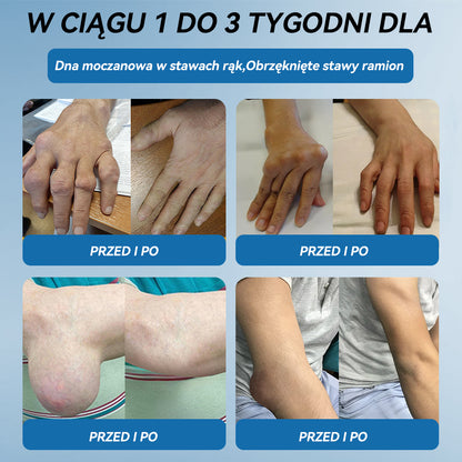 𝑃𝒊𝒄𝐝𝐨® B𝑷𝑪-157 Krem do leczenia stawów 🦴 𝐋𝐞𝐜𝐳𝐞𝐧𝐢𝐞 𝐳𝐚𝐩𝐚𝐥𝐞𝐧𝐢𝐚 𝐬𝐭𝐚𝐰ó𝐰,  𝒏𝒆𝒖𝒓𝒐𝒑𝒂𝒕𝒊𝒊, 𝒓𝒆𝒖𝒎𝒂𝒕𝒚𝒛𝒎𝒖,𝐮𝐫𝐚𝐳ó𝐰 𝐬𝐩𝐨𝐫𝐭𝐨𝐰𝐲𝐜𝐡 𝐢 𝐧𝐢𝐞 𝐭𝐲𝐥𝐤𝐨🍀