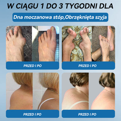 𝑃𝒊𝒄𝐝𝐨® B𝑷𝑪-157 Krem do leczenia stawów 🦴 𝐋𝐞𝐜𝐳𝐞𝐧𝐢𝐞 𝐳𝐚𝐩𝐚𝐥𝐞𝐧𝐢𝐚 𝐬𝐭𝐚𝐰ó𝐰,  𝒏𝒆𝒖𝒓𝒐𝒑𝒂𝒕𝒊𝒊, 𝒓𝒆𝒖𝒎𝒂𝒕𝒚𝒛𝒎𝒖,𝐮𝐫𝐚𝐳ó𝐰 𝐬𝐩𝐨𝐫𝐭𝐨𝐰𝐲𝐜𝐡 𝐢 𝐧𝐢𝐞 𝐭𝐲𝐥𝐤𝐨🍀