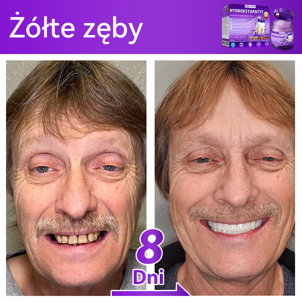 Oficjalny sklep| 𝑫𝒐𝒓𝒎𝒐𝒓𝒏𝒂® Hydroksyapatyt Proszek Do Odbudowy Zębów✅ Skutecznie leczy próchnicę, problemy z dziąsłami, nadwrażliwość zębów, afty i przebarwienia, jednocześnie poprawiając ogólną higienę jamy ustnej.🌲