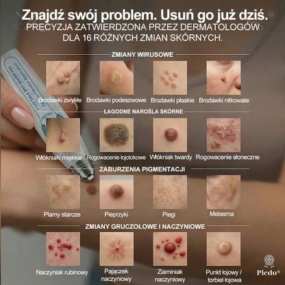 Oficjalny Sklep Markowy | ✅👩‍⚕️ 𝐏i𝐜𝐝o® 7-Dniowy 𝗧𝗮𝗴 & 𝗦𝗽𝗼𝐭 𝐄𝐫𝐚𝐬𝐞𝐫 (Bez bólu, Bez blizn – aplikator z kulką) 🎉