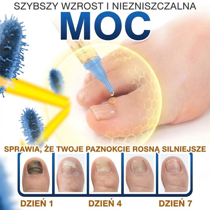 🇵🇱 CareBreeze® Fungi Free – kuracja na paznokcie na bazie jadu pszczelego 🌿1