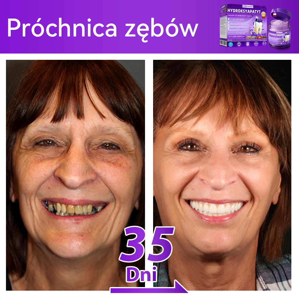 Oficjalny sklep| 𝑫𝒐𝒓𝒎𝒐𝒓𝒏𝒂® Hydroksyapatyt Proszek Do Odbudowy Zębów✅ Skutecznie leczy próchnicę, problemy z dziąsłami, nadwrażliwość zębów, afty i przebarwienia, jednocześnie poprawiając ogólną higienę jamy ustnej.🌲