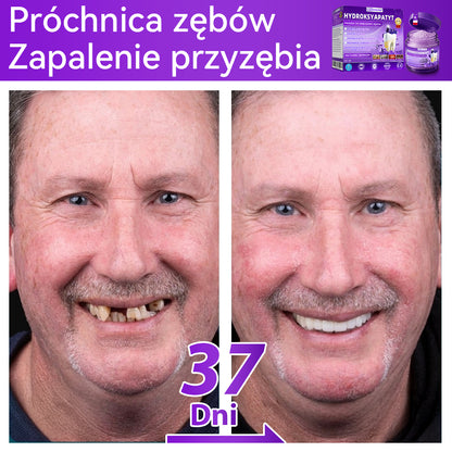 Oficjalny sklep| 𝑫𝒐𝒓𝒎𝒐𝒓𝒏𝒂® Hydroksyapatyt Proszek Do Odbudowy Zębów✅ Skutecznie leczy próchnicę, problemy z dziąsłami, nadwrażliwość zębów, afty i przebarwienia, jednocześnie poprawiając ogólną higienę jamy ustnej.🌲