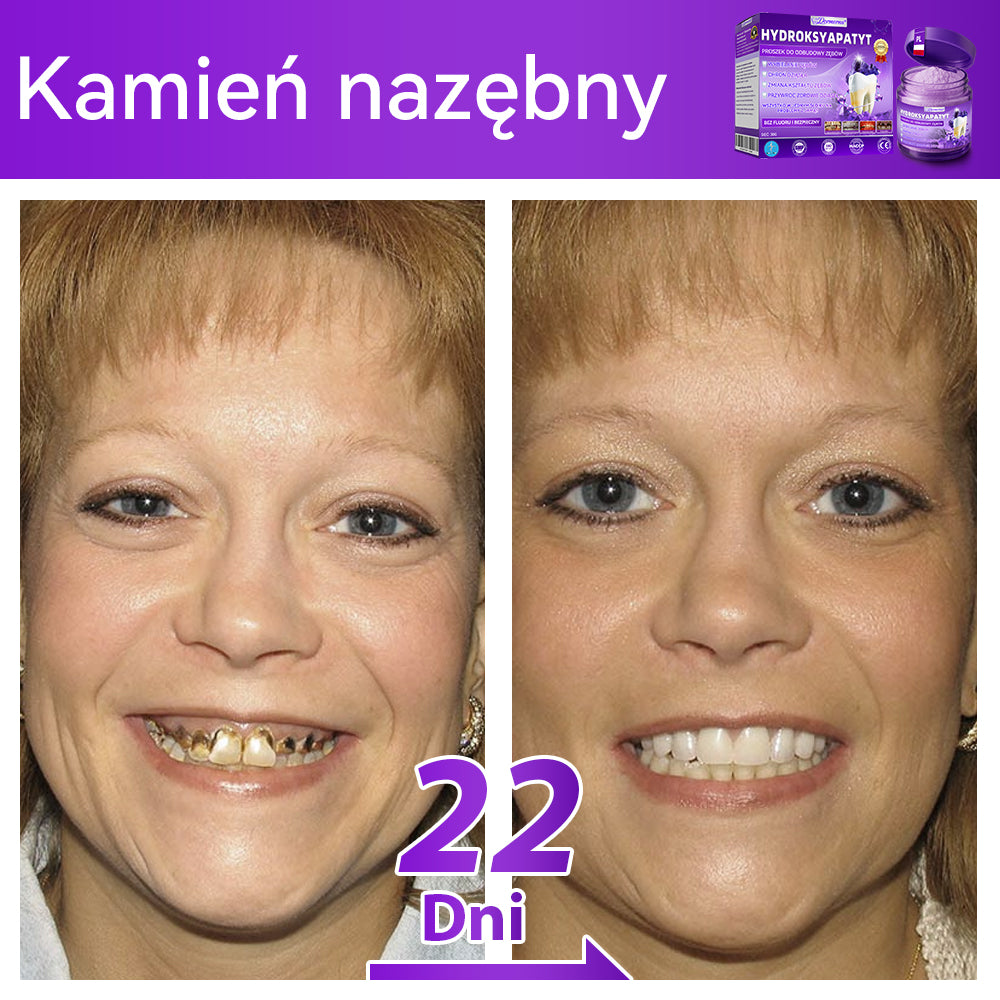 Oficjalny sklep| 𝑫𝒐𝒓𝒎𝒐𝒓𝒏𝒂® Hydroksyapatyt Proszek Do Odbudowy Zębów✅ Skutecznie leczy próchnicę, problemy z dziąsłami, nadwrażliwość zębów, afty i przebarwienia, jednocześnie poprawiając ogólną higienę jamy ustnej.🌲