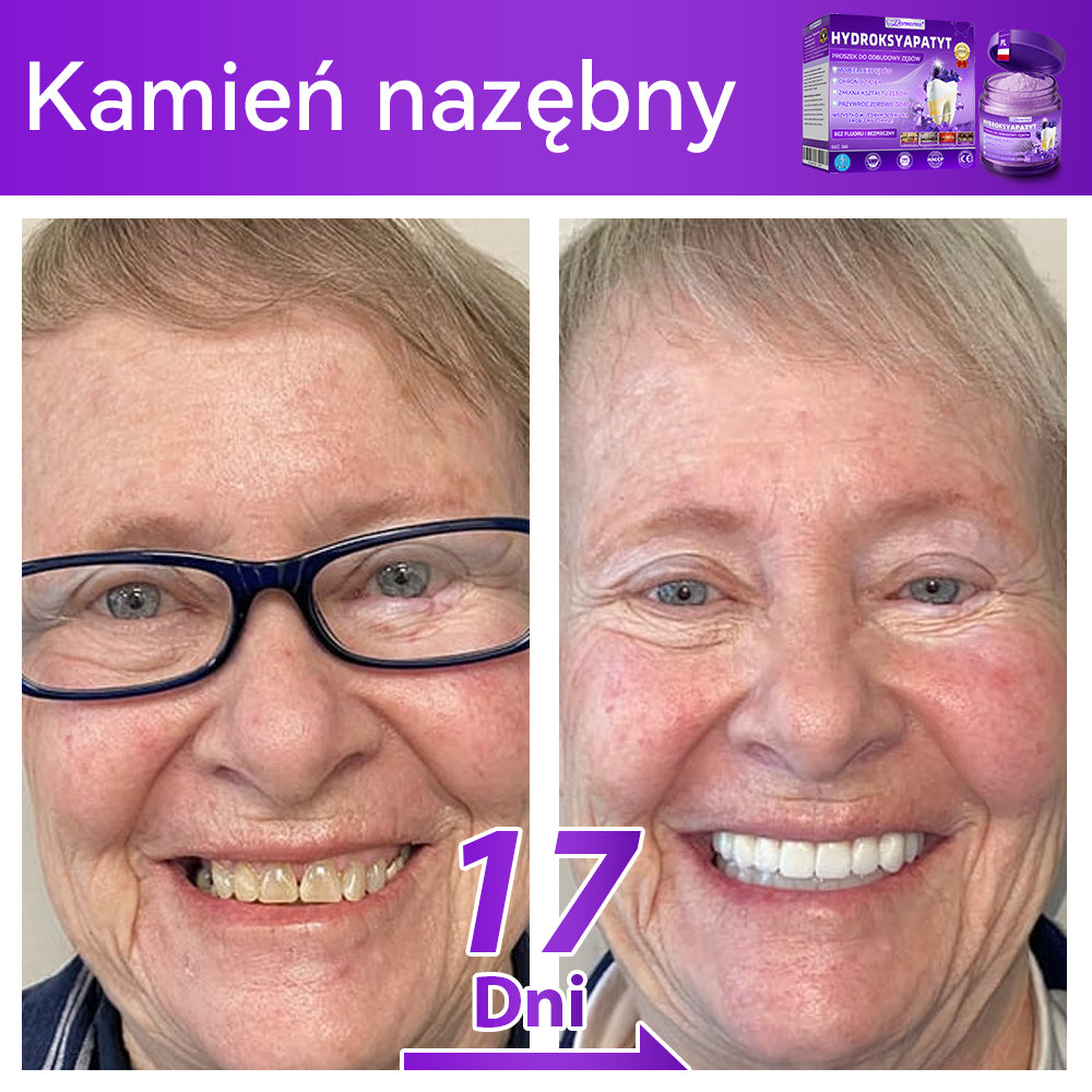 Oficjalny sklep| 𝑫𝒐𝒓𝒎𝒐𝒓𝒏𝒂® Hydroksyapatyt Proszek Do Odbudowy Zębów✅ Skutecznie leczy próchnicę, problemy z dziąsłami, nadwrażliwość zębów, afty i przebarwienia, jednocześnie poprawiając ogólną higienę jamy ustnej.🌲