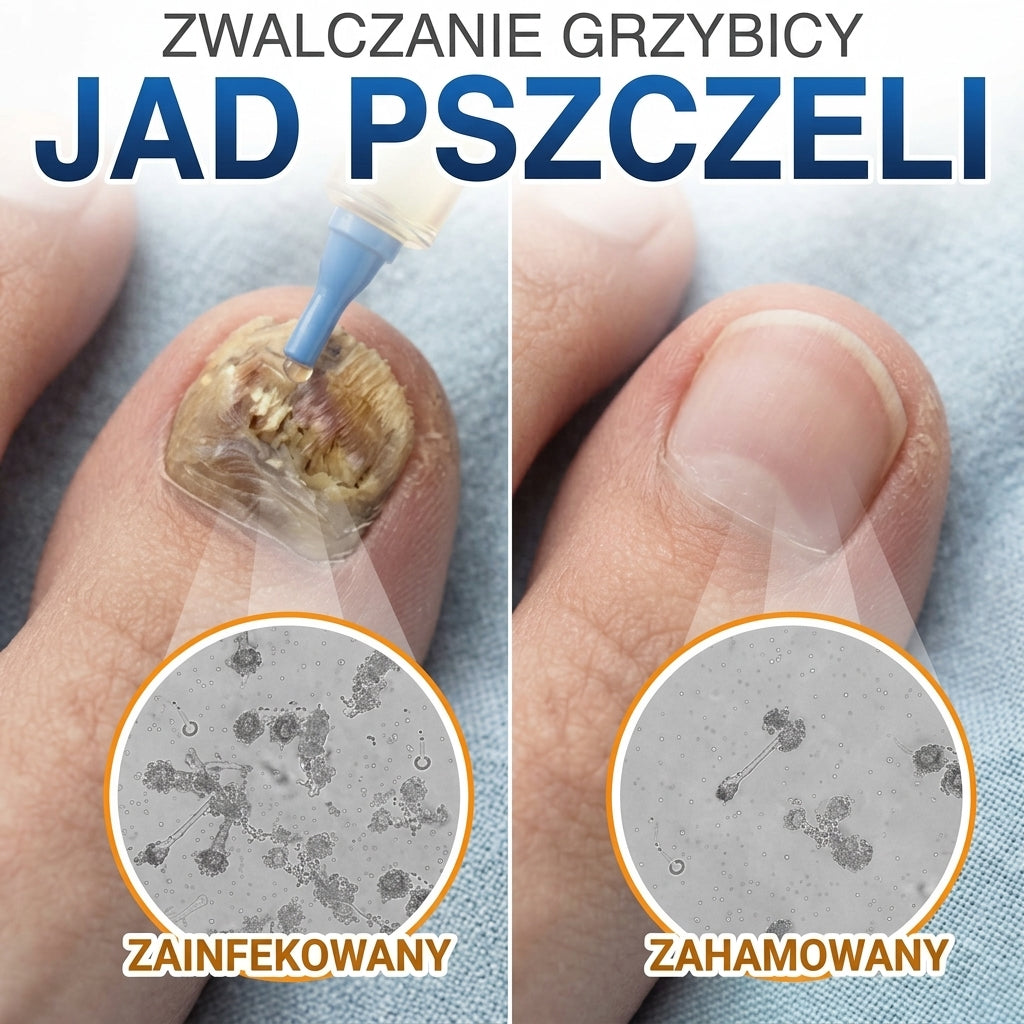 🇵🇱 CareBreeze® Fungi Free – kuracja na paznokcie na bazie jadu pszczelego 🌿1
