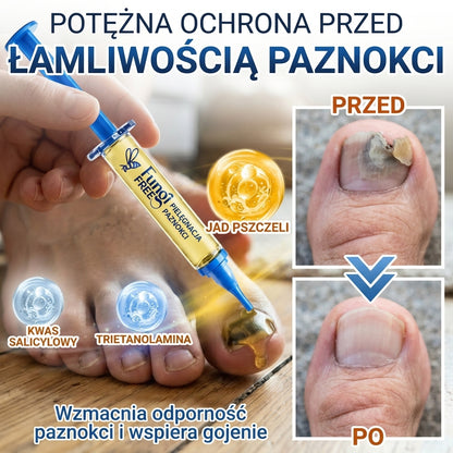 🇵🇱 CareBreeze® Fungi Free – kuracja na paznokcie na bazie jadu pszczelego 🌿1